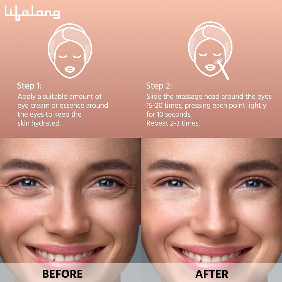 Lifelong Red Light Wrinkle Remover - EMS Microcurrent, LED Rejuvenation Therapy, Temperature Control - Anti-Aging Wrinkle Remover Device for Firm Skin and Enhanced Serum Absorption